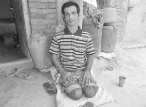 शारिरीक अपाङ्गता भएको पुरुष घरको बाहिर बस्दै गरेको अवस्था