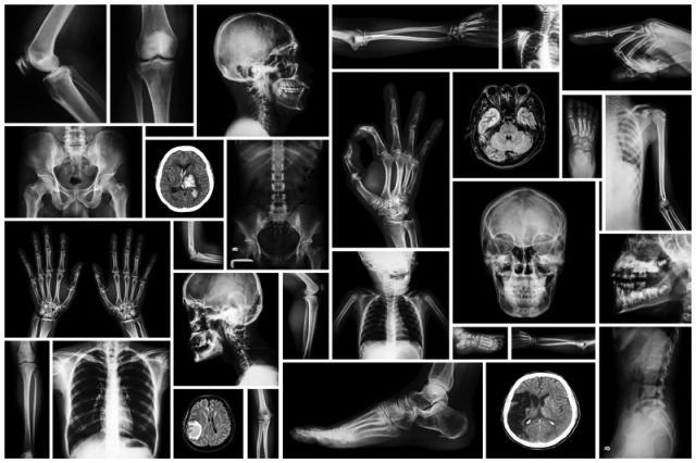 यस चित्रमा हाडजोर्नी तथा मस्तिष्क सम्बन्धी ऐक्सरे देखाइएको छ